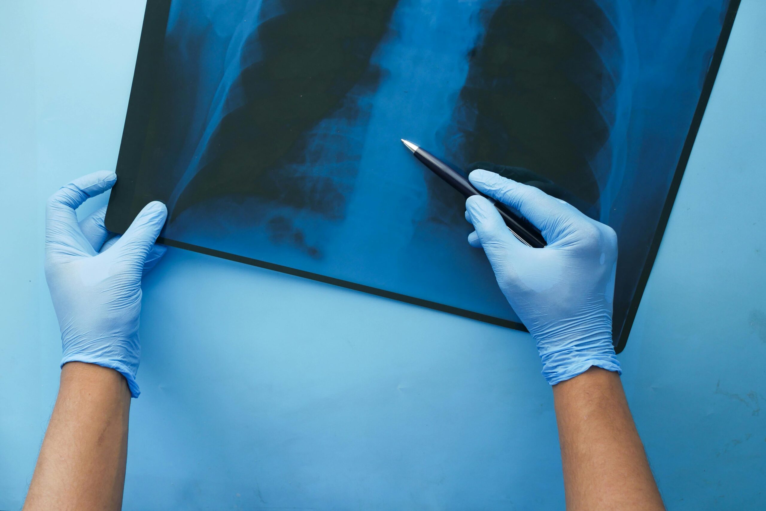 Gastrointestinal & Fatty Liver Reversal nutrition